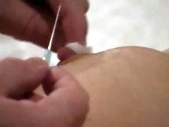 Needles in nipples